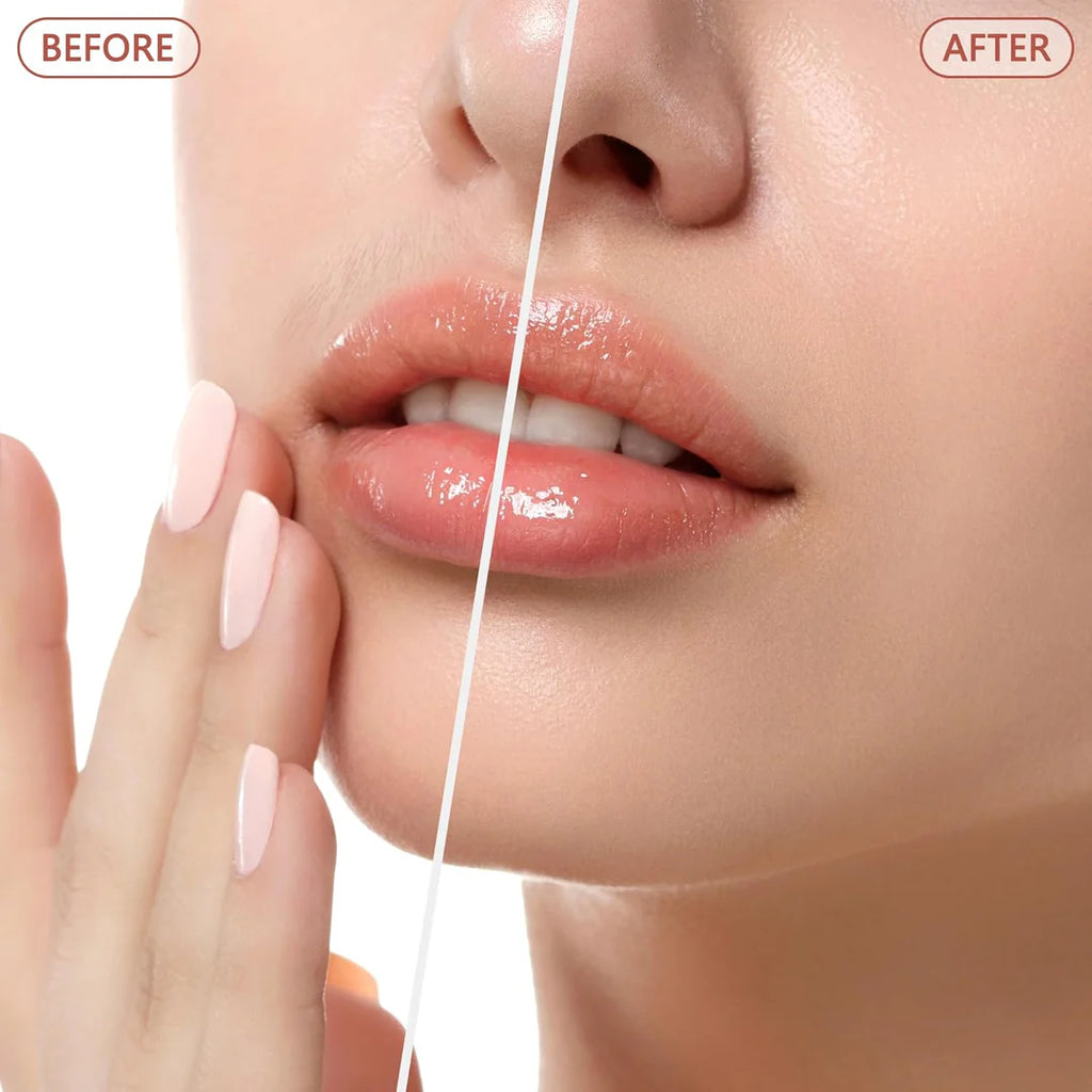 جهاز إزالة شعر الوجه -face hair remover